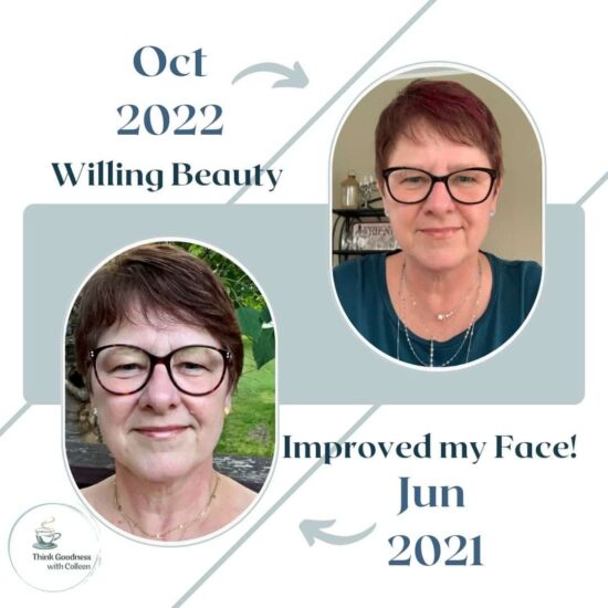 A white image with a blue stripe and 2 images of Colleen Evans, one dated Oct 2022 and one dated Jun 2021 and says Willing Beauty improved my face